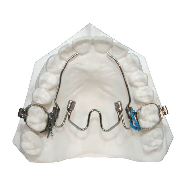 Palatal Expander - part of orthodontic treatment at Soleil