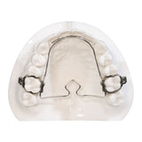Wilson 3D Multi-Action TPA