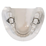 Wilson 3D Lingual Arch
